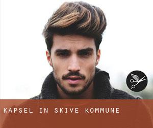 Kapsel in Skive Kommune Kapsel in Skive Kommune